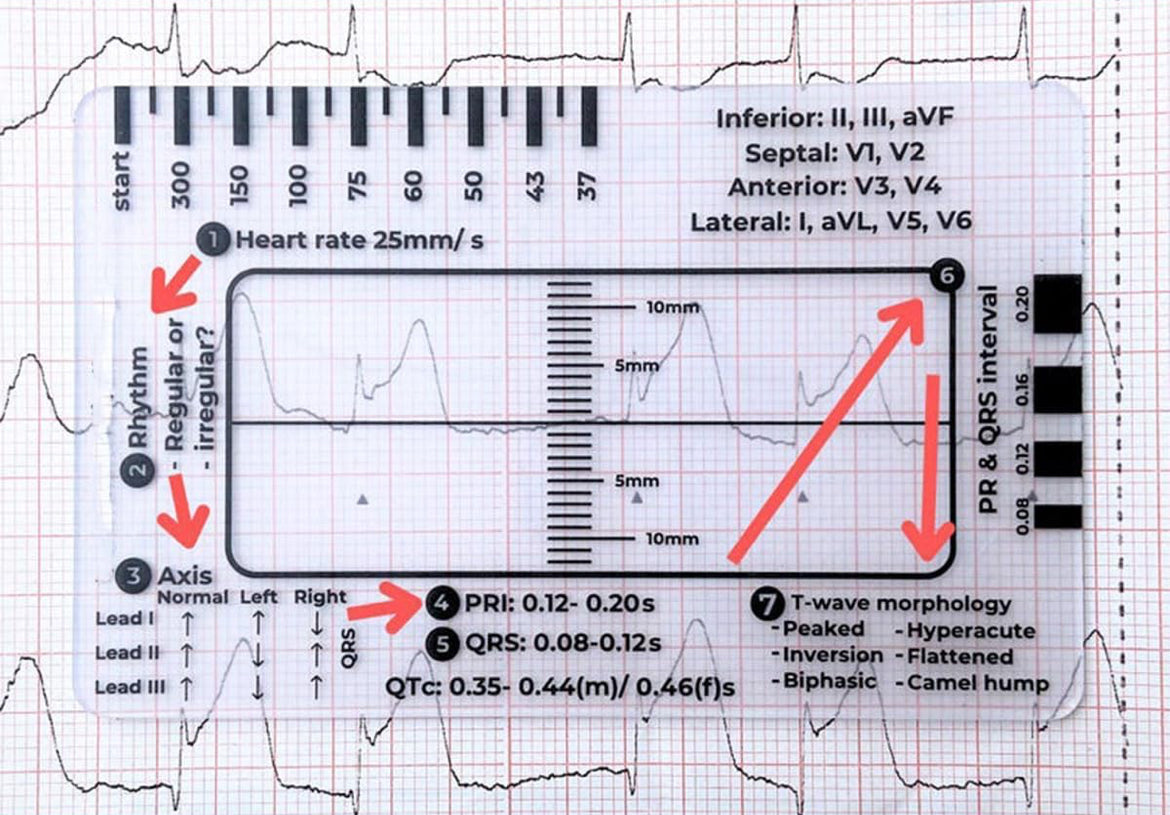 Ecg First Aid ECG Interpretation Card β Kitchener First Aid and CPR